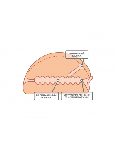 Мастурбатор вагина и анус биоклон 650001